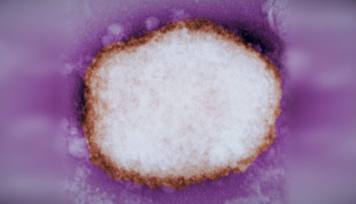 variole-du-singe-CDC